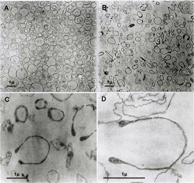 Osmotic Vesicle Collapse of Sealed Inside–Out Membrane Vesicles From Red Blood Cells